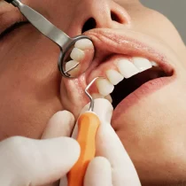 Endodoncia en Sevilla: Salvando Dientes y Sonrisas 4 Endodoncia en Sevilla: Salvando Dientes y Sonrisas